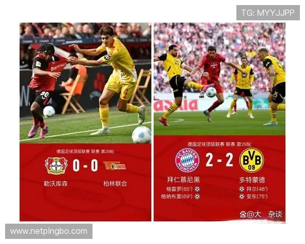 凯恩越高效，拜仁进攻越畸形？问题已逐步反映在比赛走势中